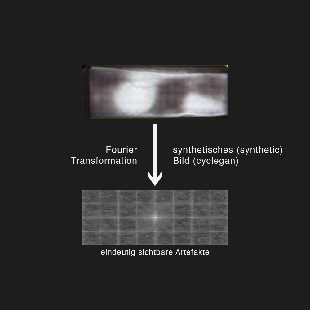 Fourier-Transformation eines synthetisch-erstellen Scans (cyclegan)